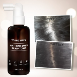 [Hair loss spray] Youngways Anti Hair Loss Scalp Tonic / Biotin / Mugwort / Polygonum multiflorum / Caffeine